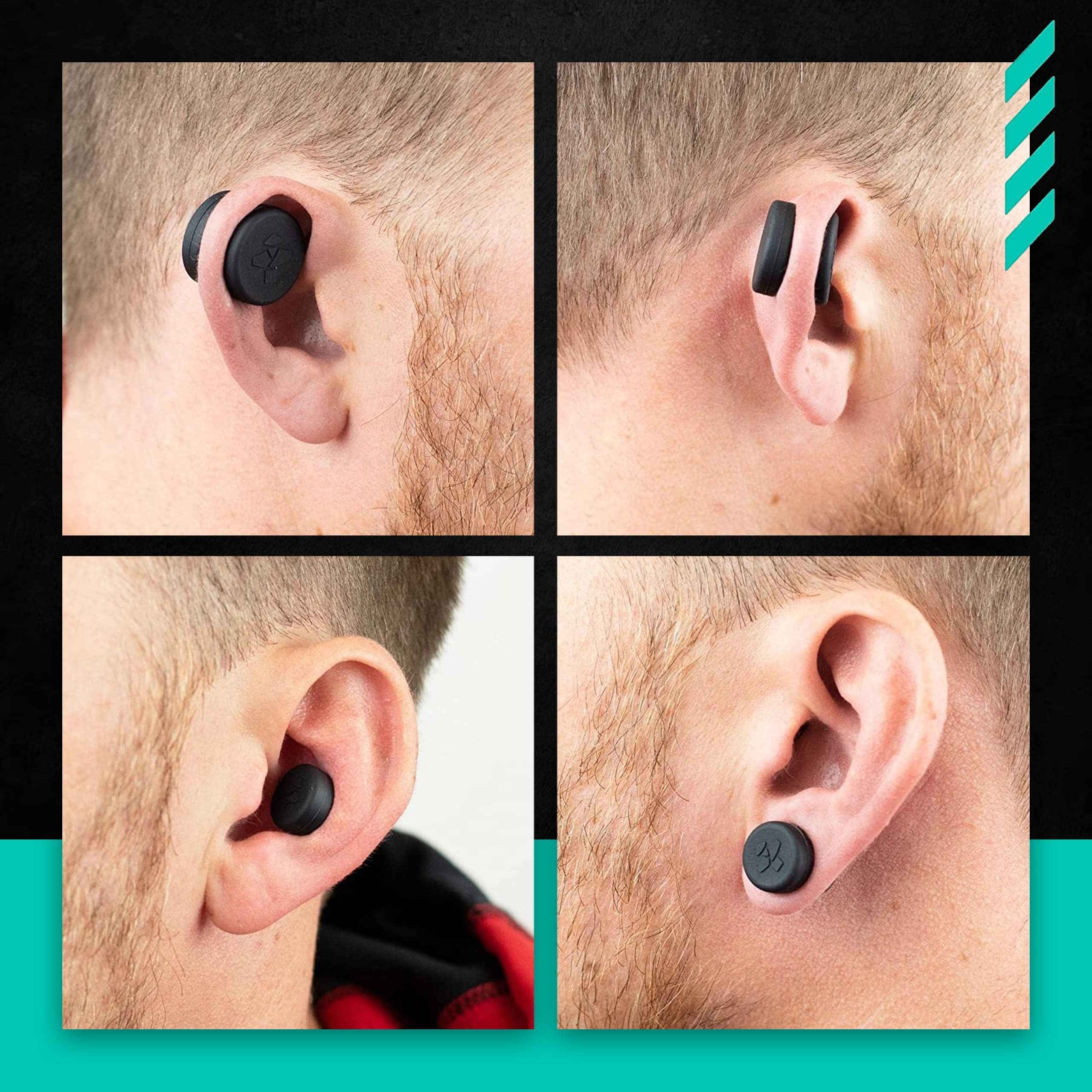 Cauliflower Ear Magnets | 8 Magnets + 8 Compression Reduction Discs Included. Cauliflower Ear Draining Kit for Treatment and Protection Against Scarring