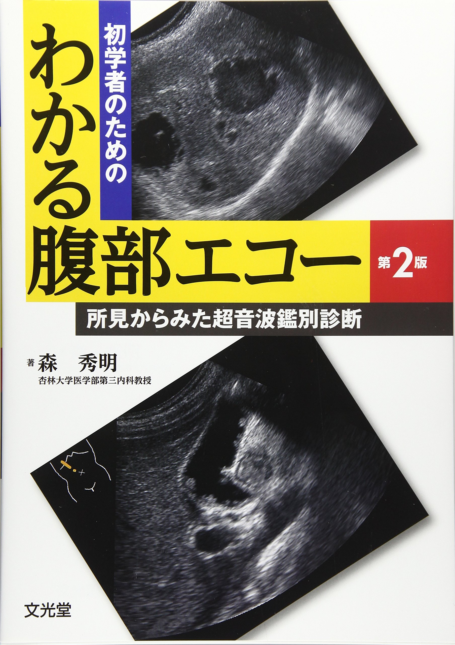 初学者のためのわかる腹部エコー 所見からみた超音波鑑別診断 秀明 森 本 通販 Amazon
