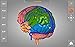 Brain - 3D Atlas of Anatomy
