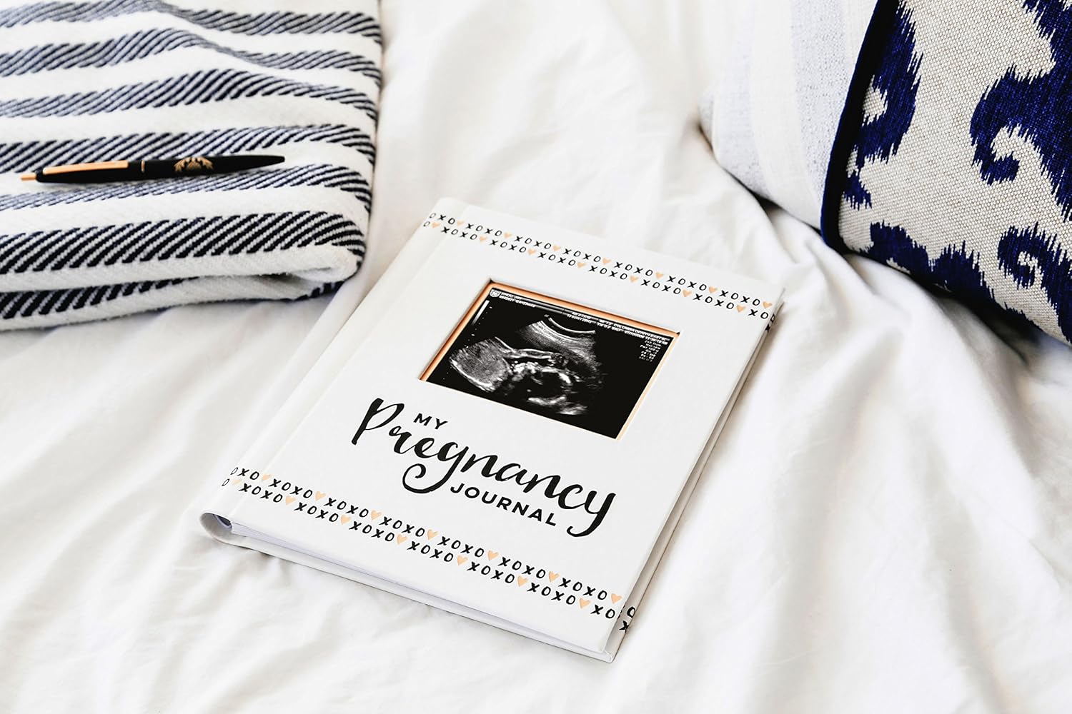 Pearhead My Pregnancy Journal, Pregnancy Book, Capture Every Precious Moment of Your Pregnancy, Gift for New Mom : Baby