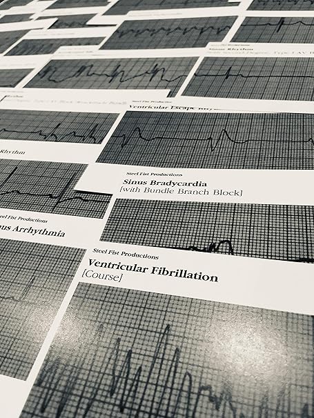 Amazon Com Ekg Ecg Cardiac Acls Rhythm Strip Flashcards Everything Else