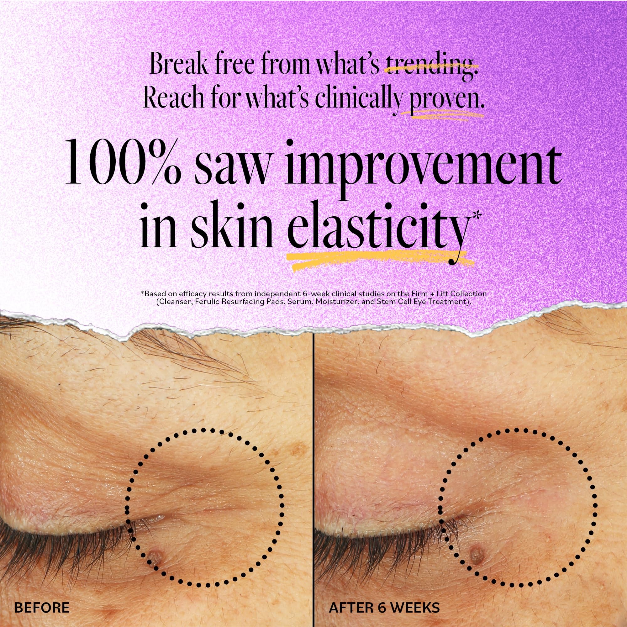 Derma E Stem Cell Lifting Eye Treatment – Multi Action Firming and Tightening Under Eye and Upper Eyelid Cream - Hydrating and Revitalizing Moisturizer, 0.5oz