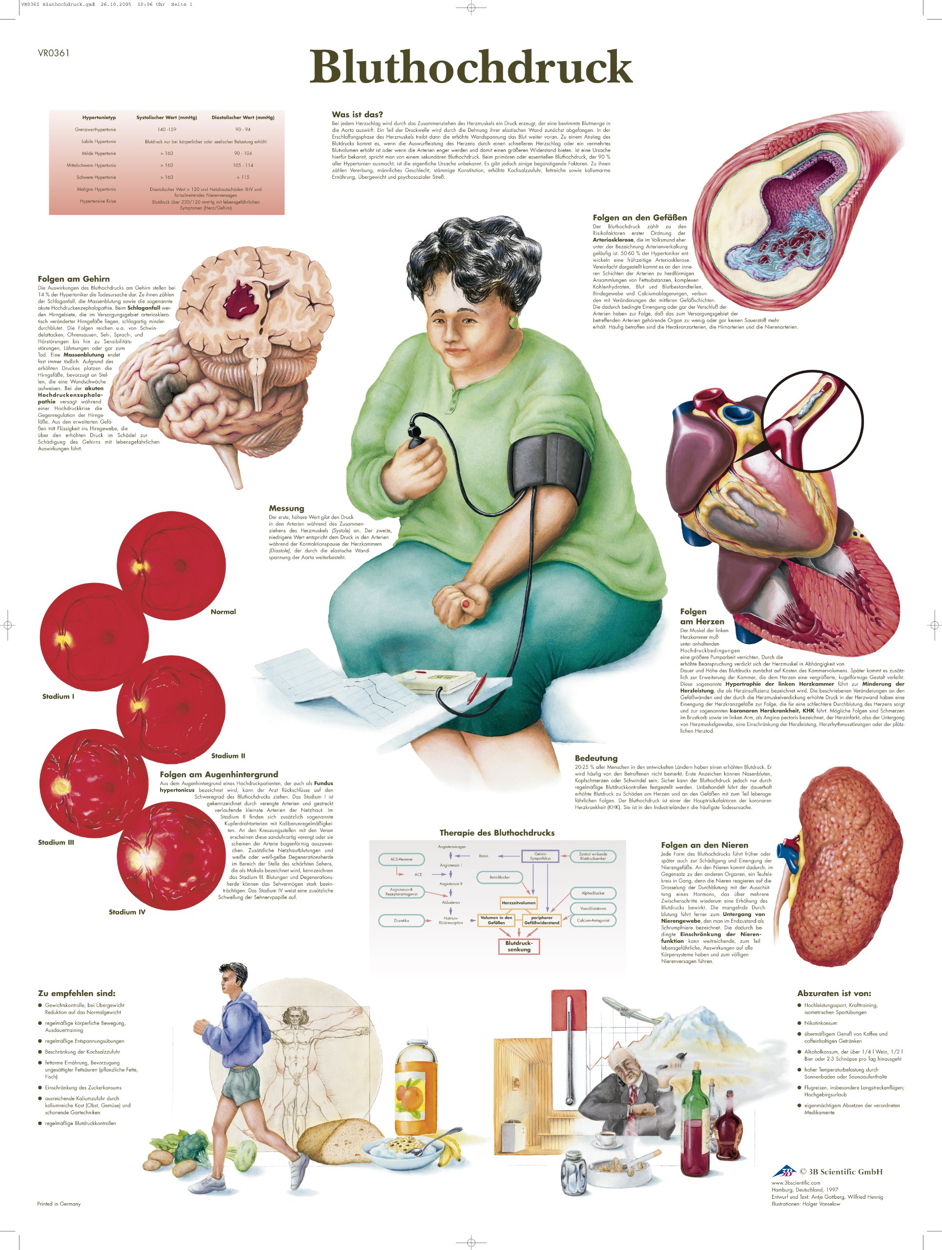 3B Scientific Chart Hypertension, 1
