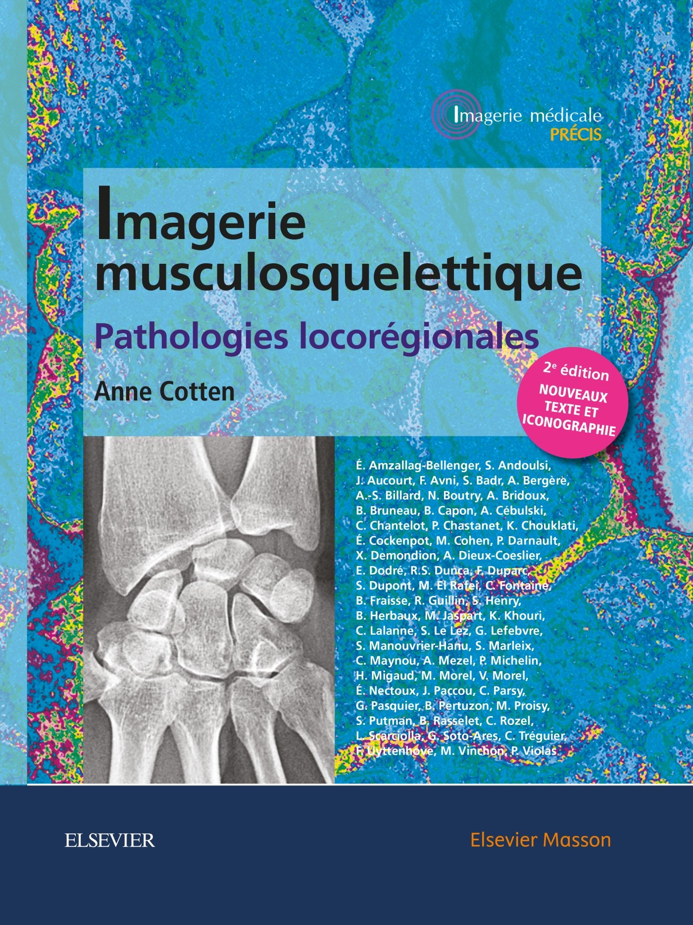 Amazon Fr Imagerie Musculosquelettique Pathologies Locoregionales Patho Locoregionales Cotten Anne Livres