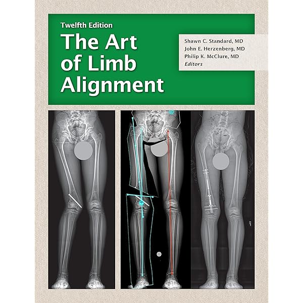 Amazon.com: The Art of Limb Alignment: Taylor Spatial Frame eBook