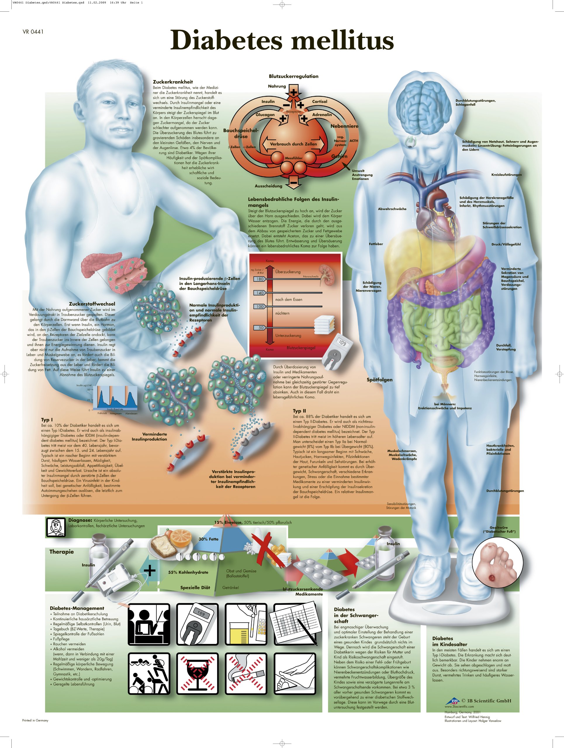 3B Scientific Anatomical Chart 'Diabetes Mellitus' (German Language)