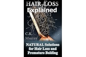 Hair Loss Explained - Natural Solutions for Hair Loss and Premature Balding: (Natural Hair Care, Hair Loss, Scalp Treatments,