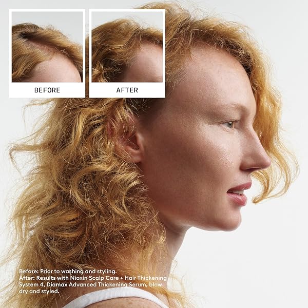 NIOXIN SCALP + HAIR THICKENING SYSTEM 4 |FOR COLORED OR DAMAGED HAIR WITH PROGRESSED THINNING| WITH NIACINAMIDE AND BIOTIN | FULL SIZE| 3 MONTH SUPPLY