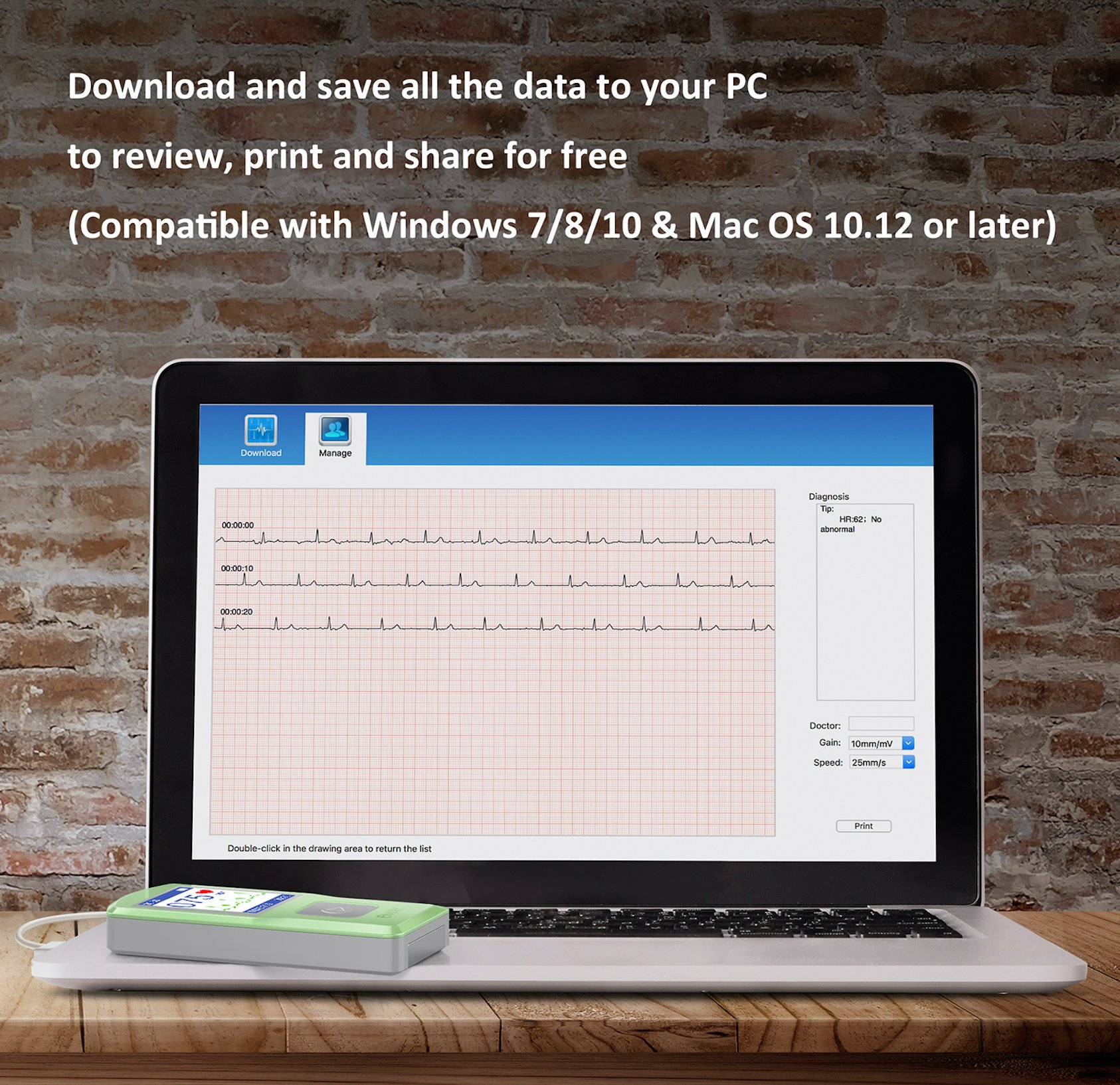 EMAY Portable ECG/EKG Monitor (PC Software Compatible With Both Windows