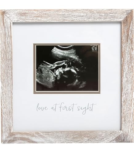 Sonogram Picture Frame Baby Triple Ultrasound Scan Photo Frame