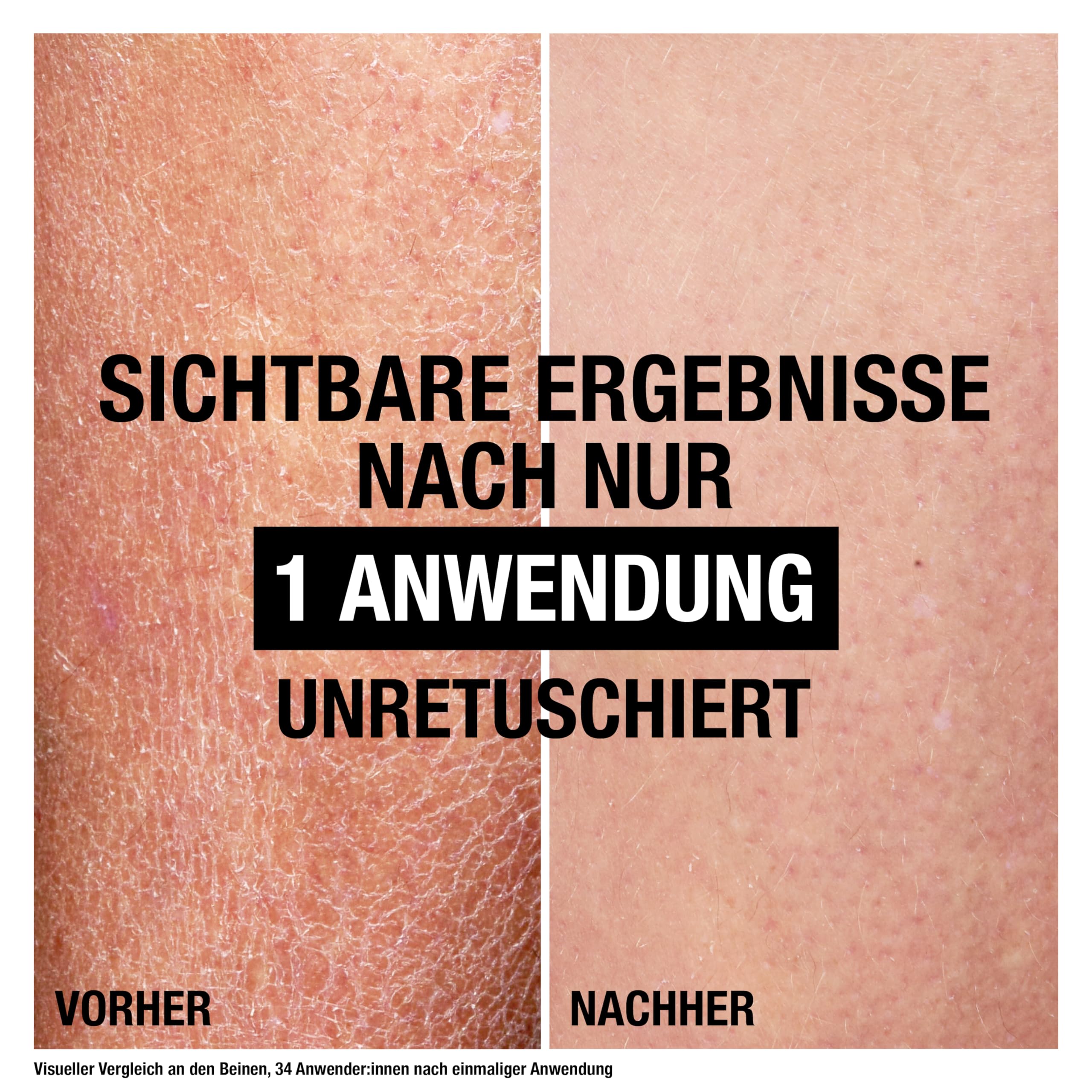 Neutrogena Norwegische Formel Deep Moisture Sensitive Bodylotion (400 ml) für trockene, empfindliche Haut mit 10 Prozent Glycerin + Pro-Ceramide Technologie 2