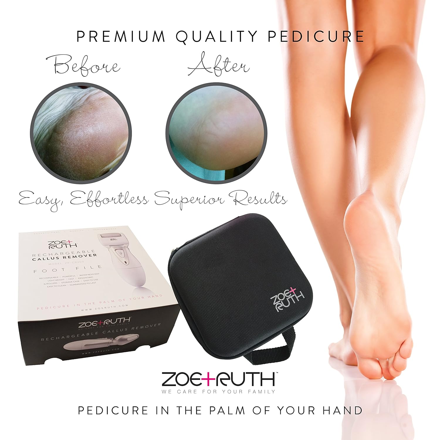 Electric Callus Remover USB Rechargeable Pedicure Foot File tool by Zoe+Ruth for Dry Cracked Dead Skin on your Heels and Feet. International Charger, 3 Rollers & Travel Friendly Storage Case. : Beauty