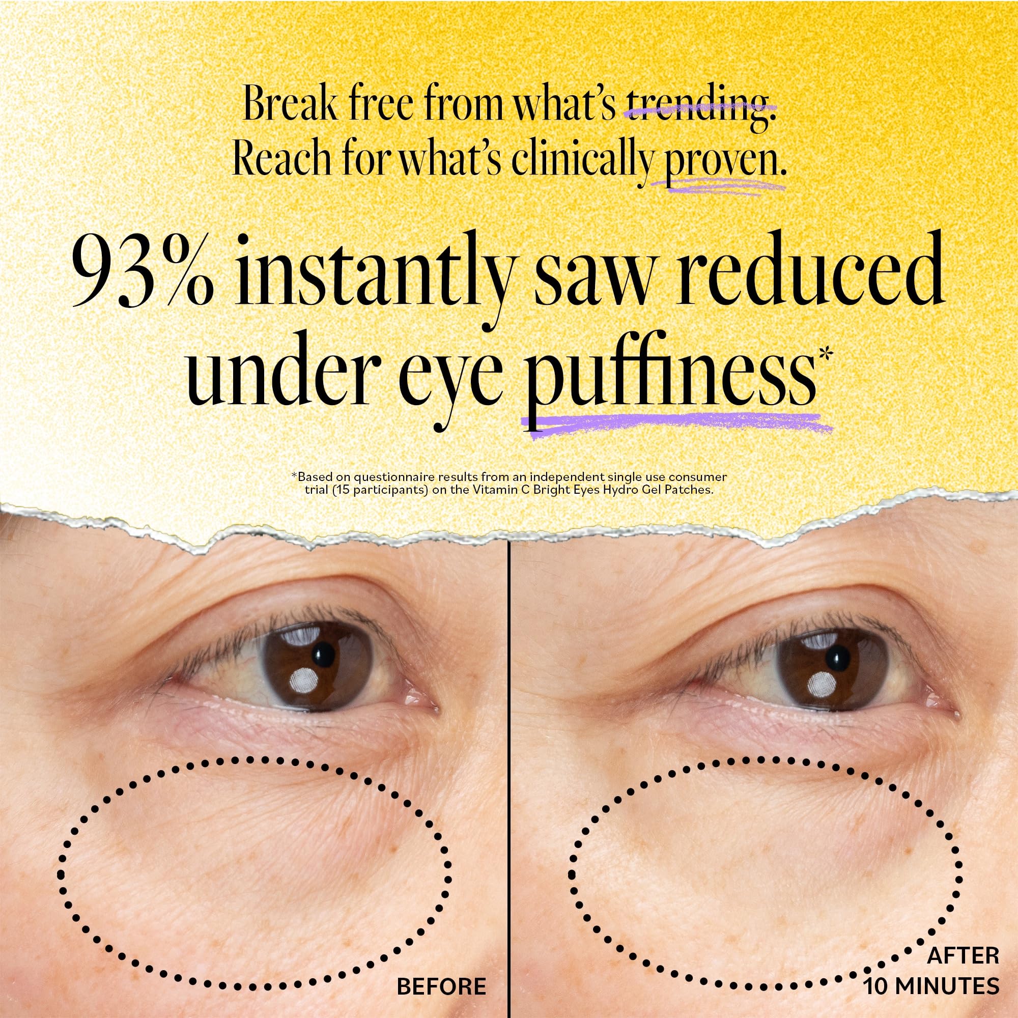 Derma E Vitamin C Bright Eyes Hydro Gel Under Eye Patches for Dark Circles (60 Ct, 30 Pairs) Allantoin, Caffeine & Vitamin B3, Collagen Eye Patches for Fine Lines, Wrinkles, Dark Circles & Puffy Eyes