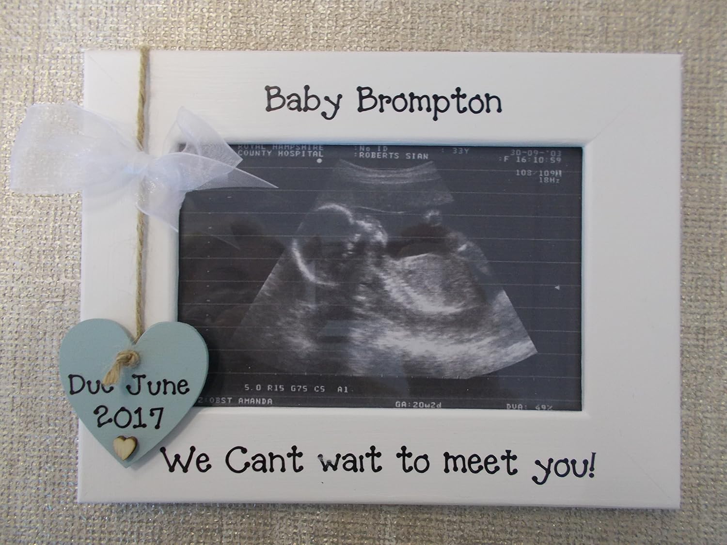 personalised scan frames