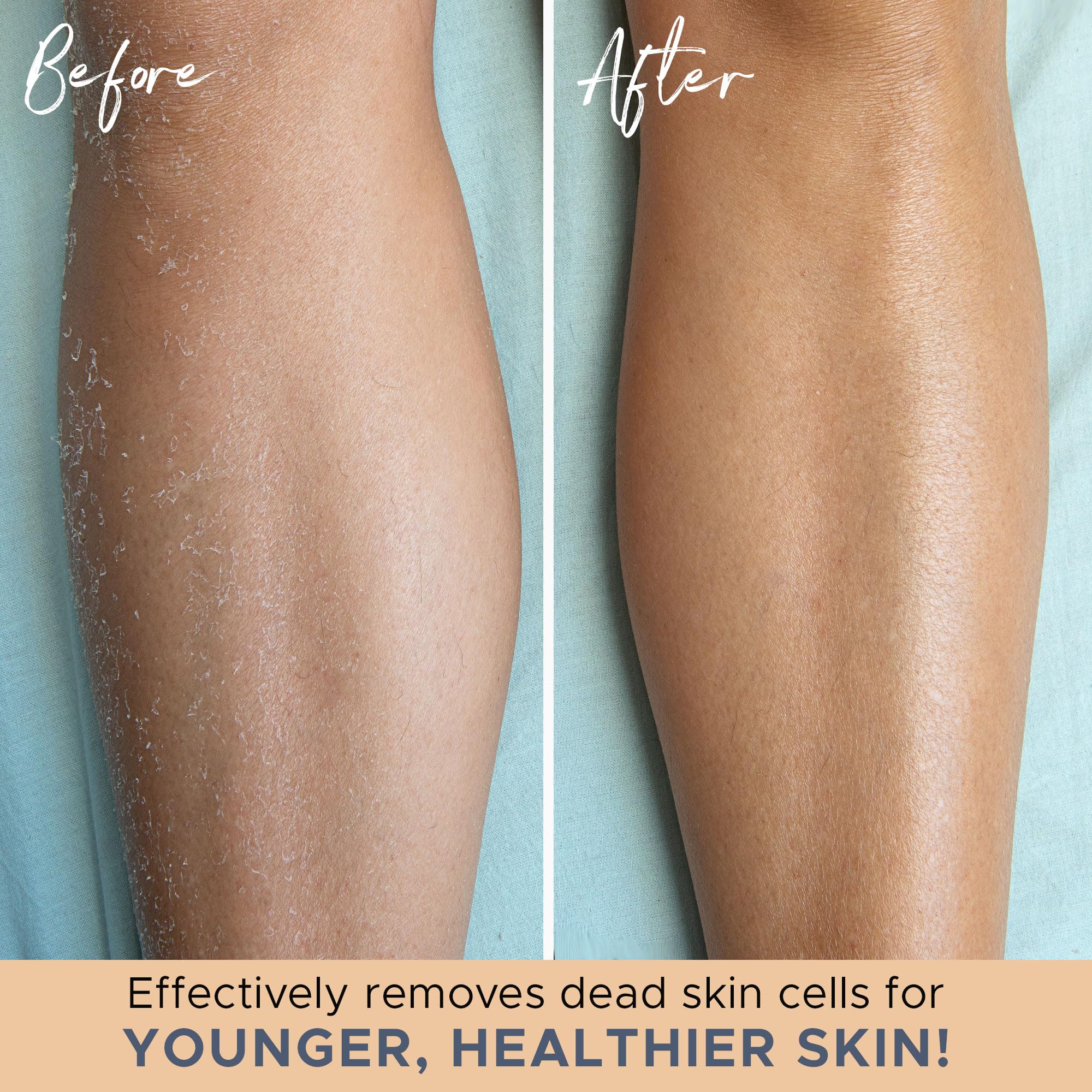 Exfoliating Glove (4 pcs, 2 Pairs) - Heavy Shower Gloves for Body Scrub, Exfoliates & Removes Dead Skin, Stocking Stuffers for Women and Men