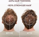 Klorane Strengthening Quinine Edelweiss Shampoo 400ml Tired Hair Loss Sulphate view 3