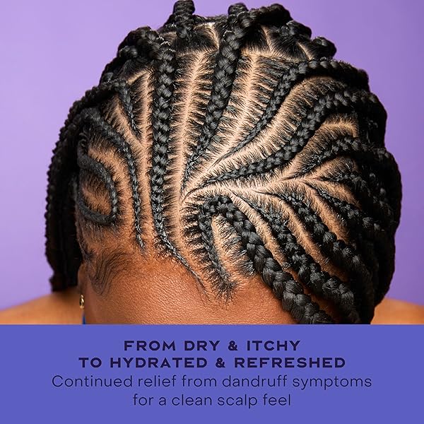 SHEAMOISTURE INSTANT SCALP REFRESH ANTI-DANDRUFF SPRAY WITH SALICYLIC ACID AND SCALP REPAIR TECHNOLOGY HYDRATES DRY SCALP, REMOVES BUILDUP AND CONTROLS ITCH AND FLAKES 4 FL OZ