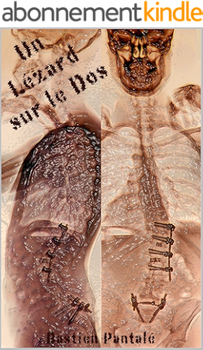 Download Un Lézard sur le Dos: Catharsis d'un douloureux chronique PDF