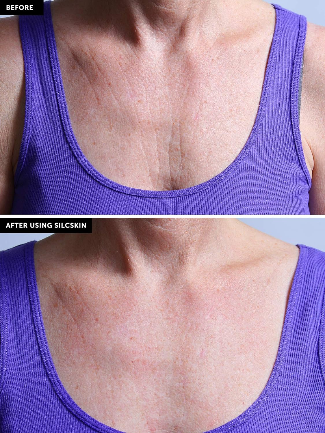 SilcSkin Decollette Pad: Premium Beauty