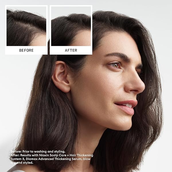 NIOXIN SYSTEM 3 SCALP + HAIR SHAMPOO | FOR COLORED OR DAMAGED HAIR WITH LIGHT THINNING | WITH NIACINAMIDE AND BIOTIN | 33.8 FL OZ.