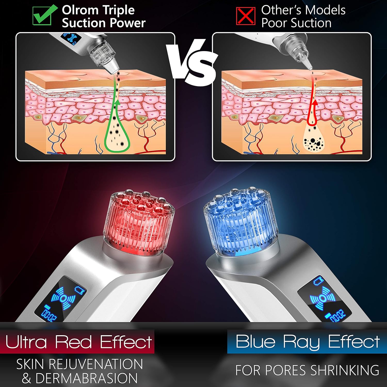 Olrom Blackhead Remover – Electric Vacuum Suction Blackhead Remover w/LED Display – Powerful Acne & Pore Cleanser –– Blackhead Removal Tool –– 5 Suction Heads – Black Heads Extraction for Women & Men: Beauty
