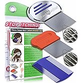 OWNHEALER Professional Lice Comb | Premium Design for Family Hair Types, Head Lice, Nit & Dandruff Removal | Peigne à poux | 