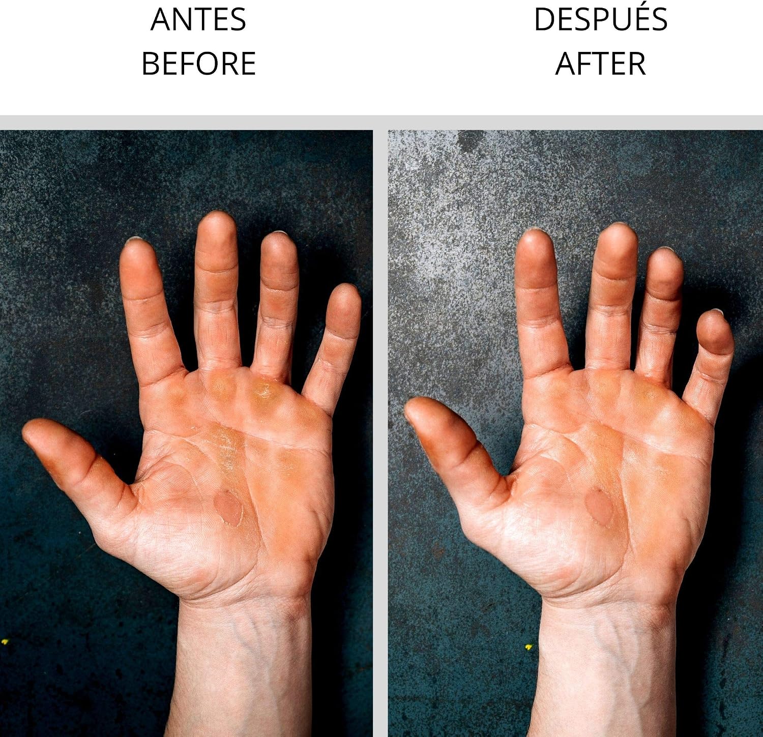 Velites Strong Sand Paper Spare Part for Callus Remover and Skin Care System for Athletes. Hand and Feet Callus Remover for Crossfit Gymnastics - Image 3