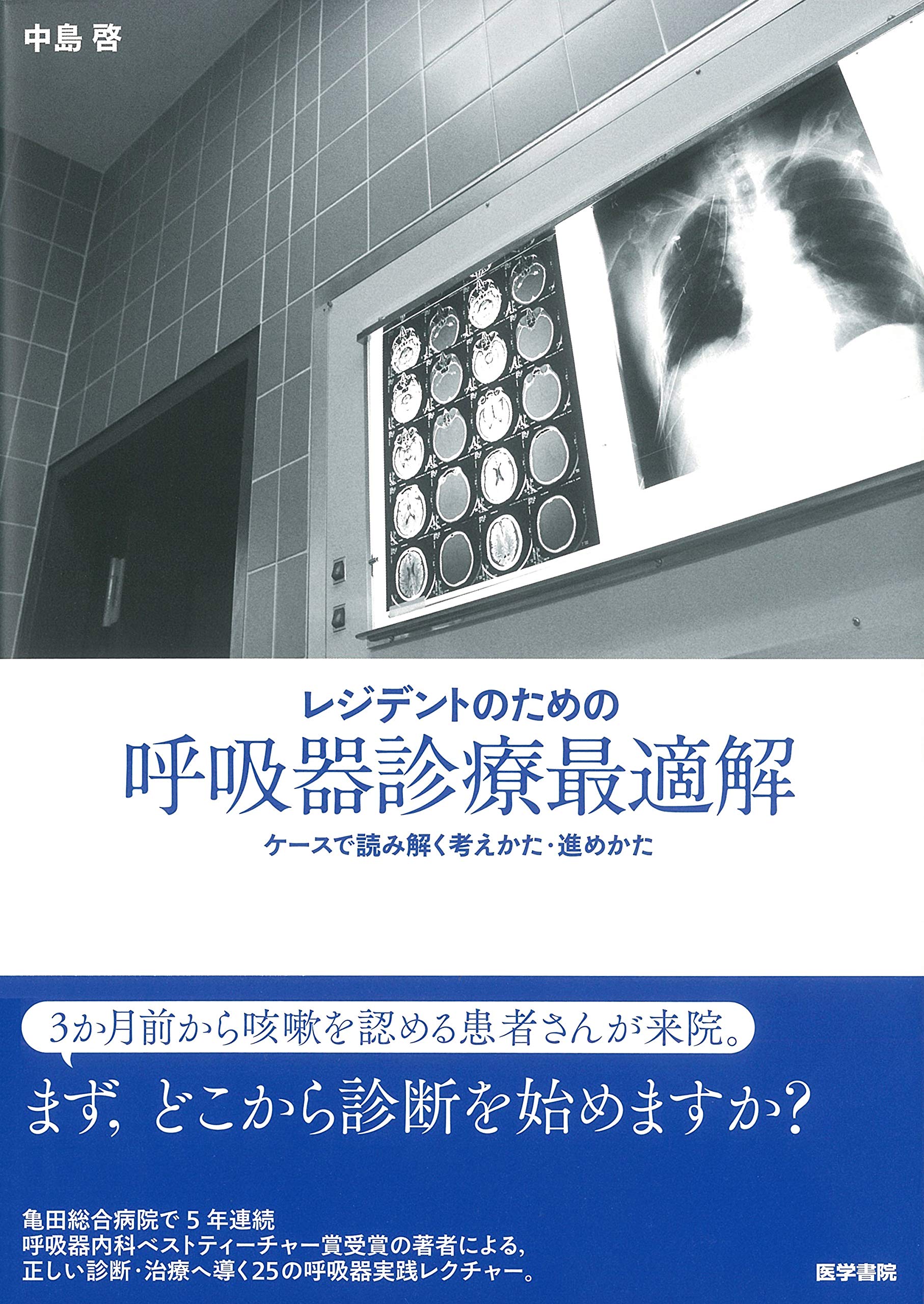 レジデントのための 呼吸器診療最適解 中島 啓 本 通販 Amazon