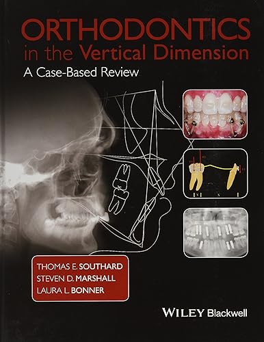 Download Orthodontics in the Vertical Dimension: A Case–Based Review PDF