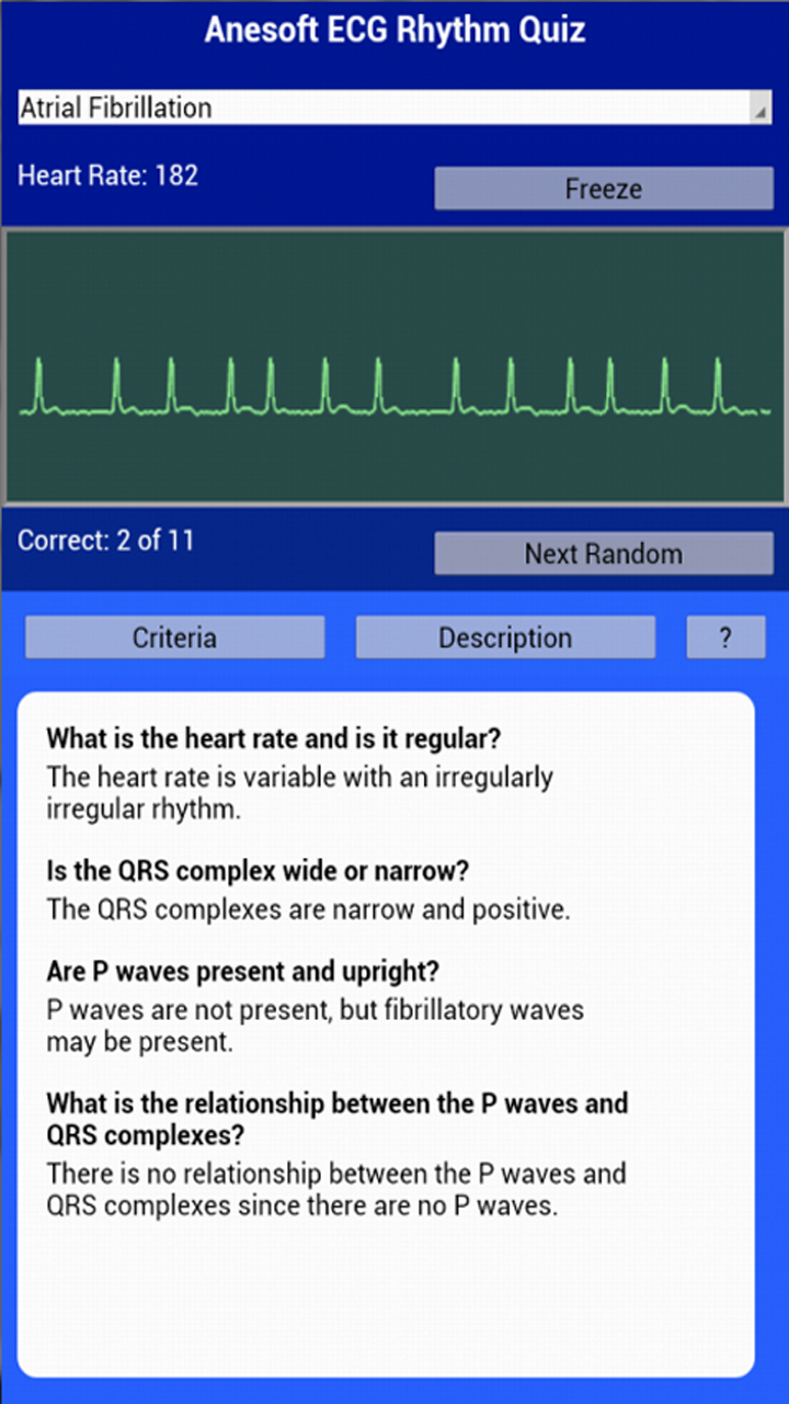 ECG Rhythms Quiz Apps & Games