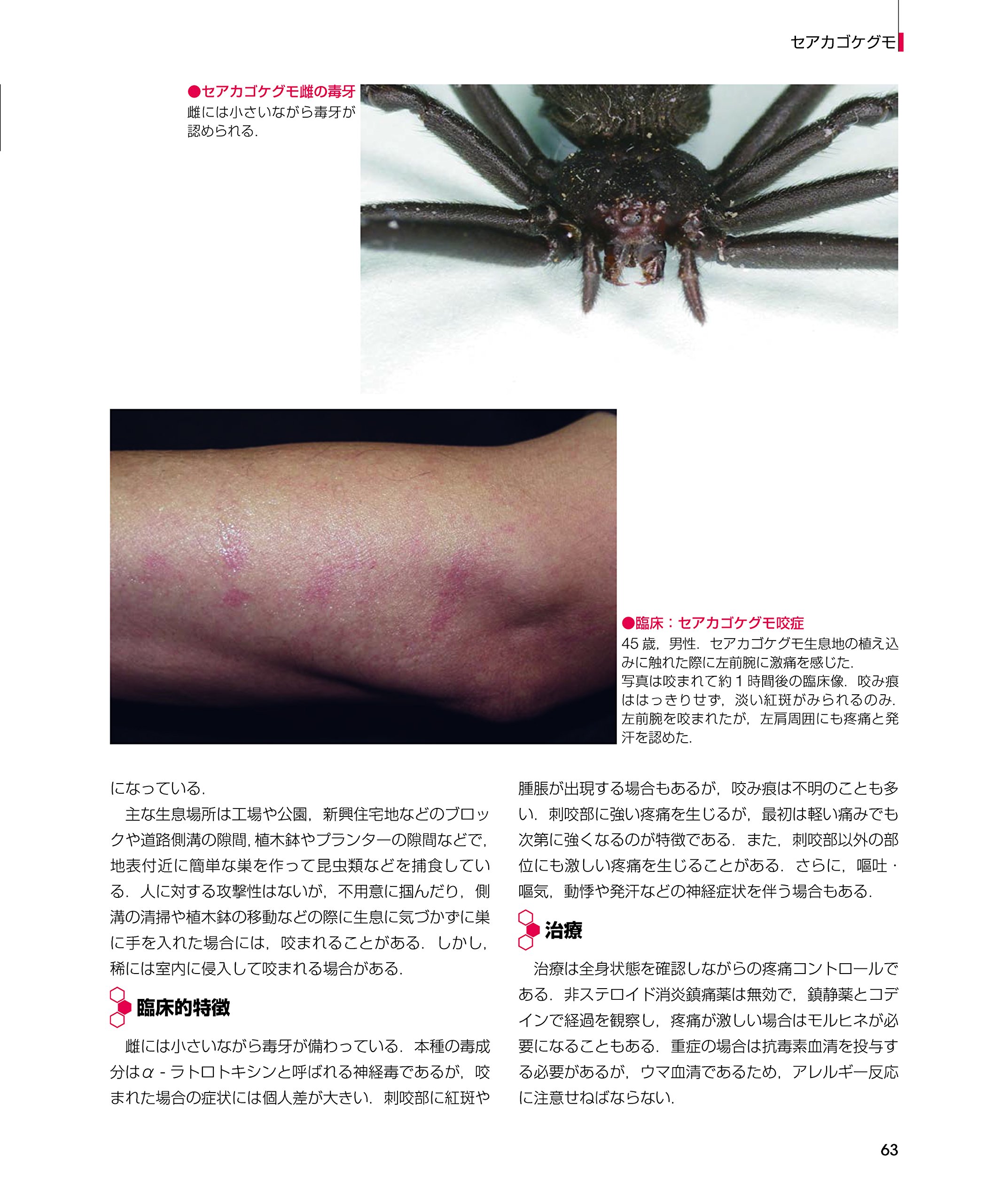 Dr 夏秋の臨床図鑑 虫と皮膚炎 夏秋優 本 通販 Amazon