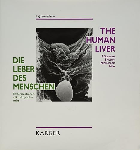 Download The Human Liver: A Scanning Electron Microscopic Atlas/Die Leber Des Menschen : Rasterelektronenmikroskopischer Atlas PDF