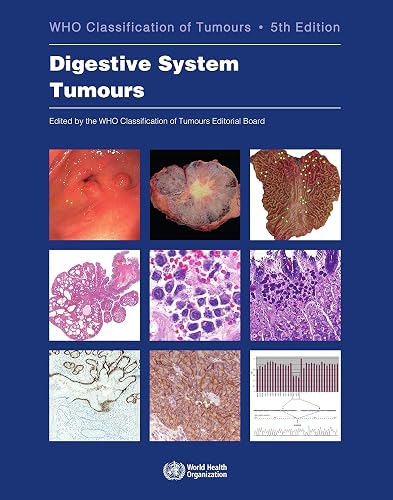 Download Digestive System Tumours PDF