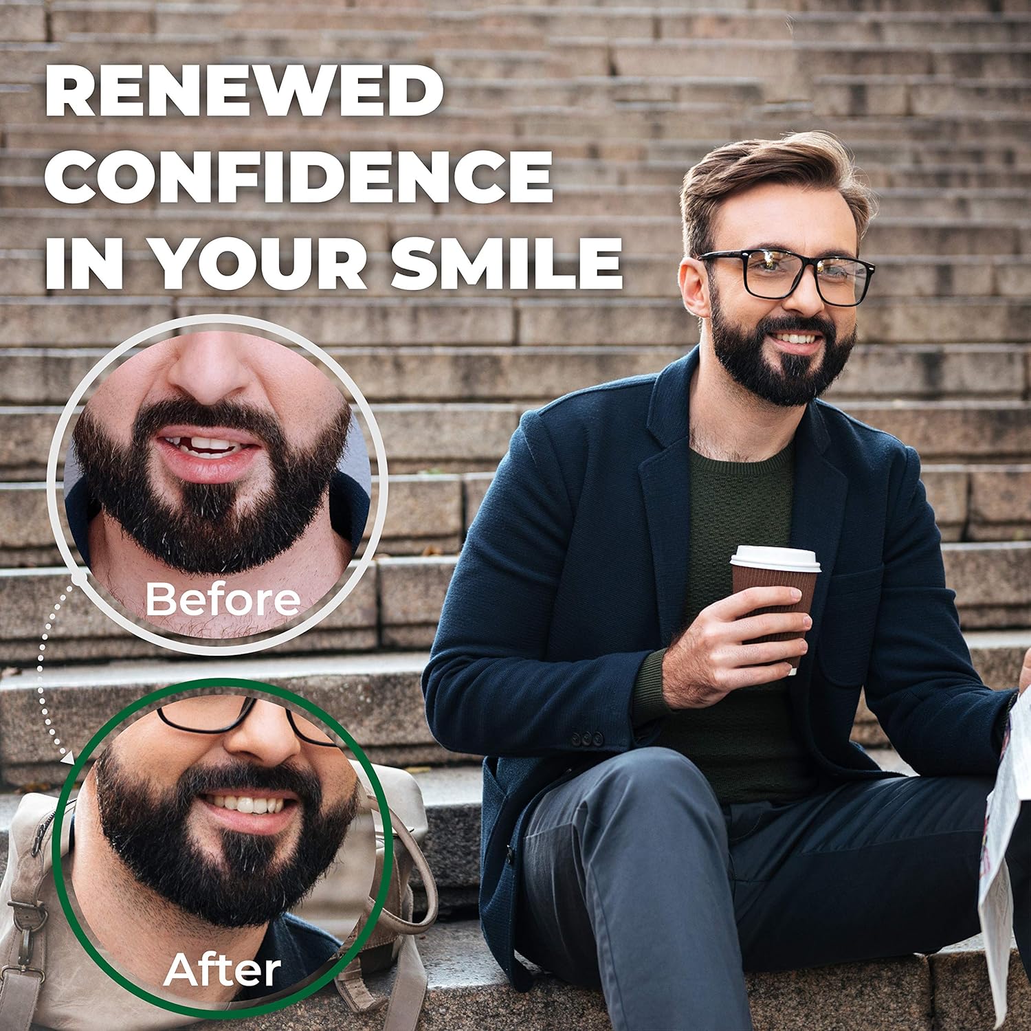 Amazing Temporary Tooth Kit 3 Pack Replacement Temp Dental 25% More Than Others : Beauty