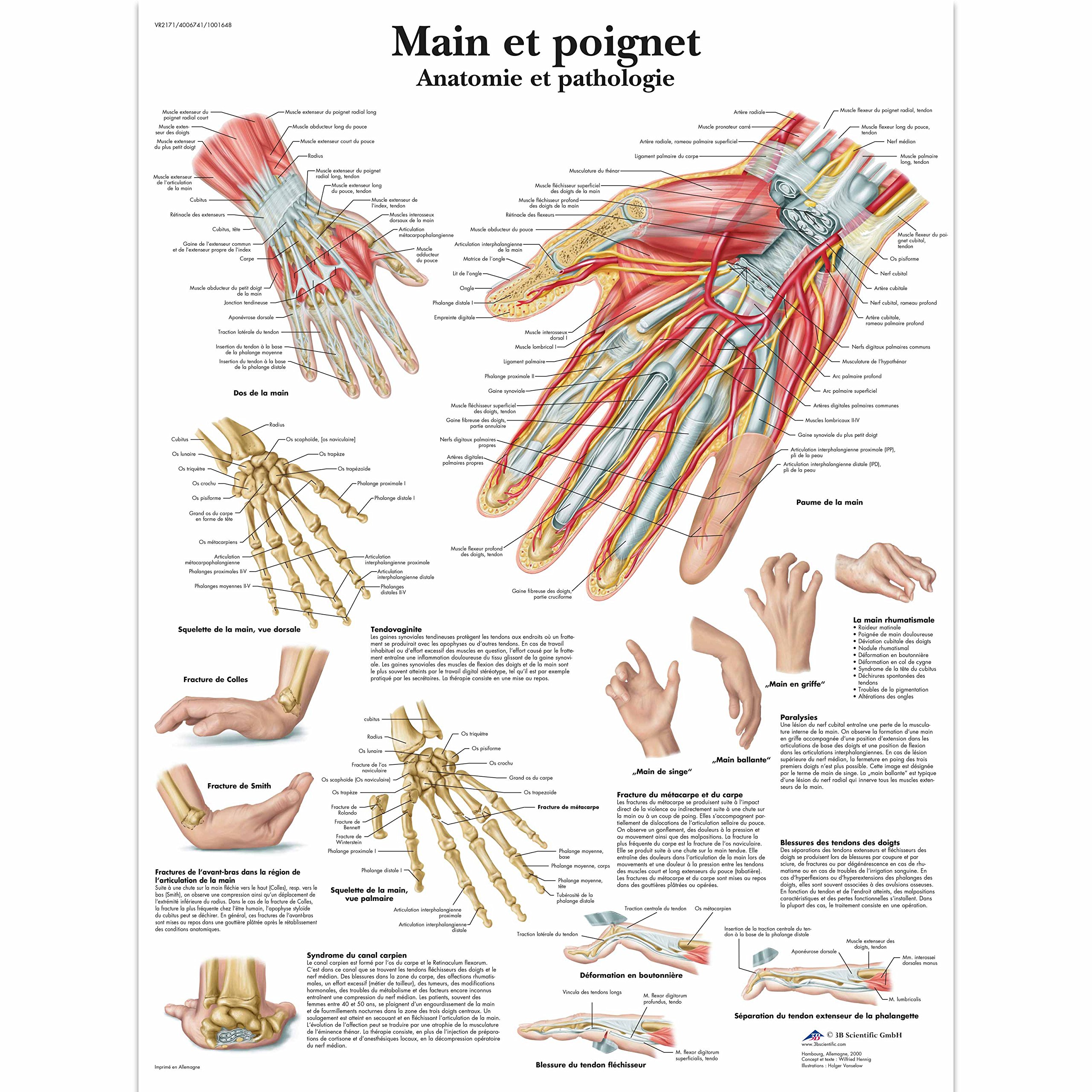 3B Scientific VR2171UU Anatomical Chart "Main et Poignet - Anatomie et Pathologie", Paper Version