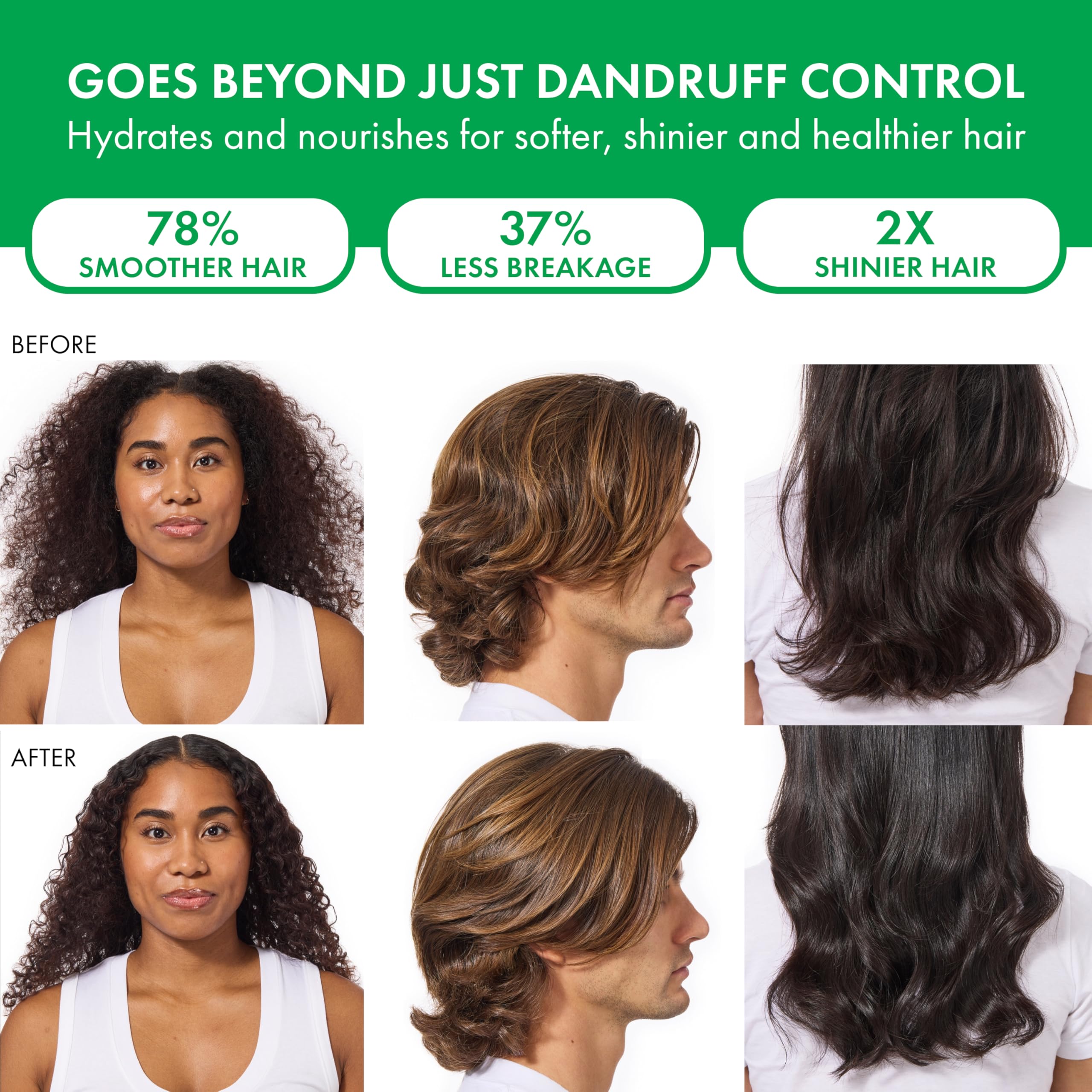 Dercos Selenium Sulfide Anti Dandruff Shampoo, Dry Scalp Treatment and Itch Relief. Prescription Strength Comparable to 2% Ketoconazole, for Mild to Severe Dandruff-Prone Hair & Flaky, Itchy Scalps