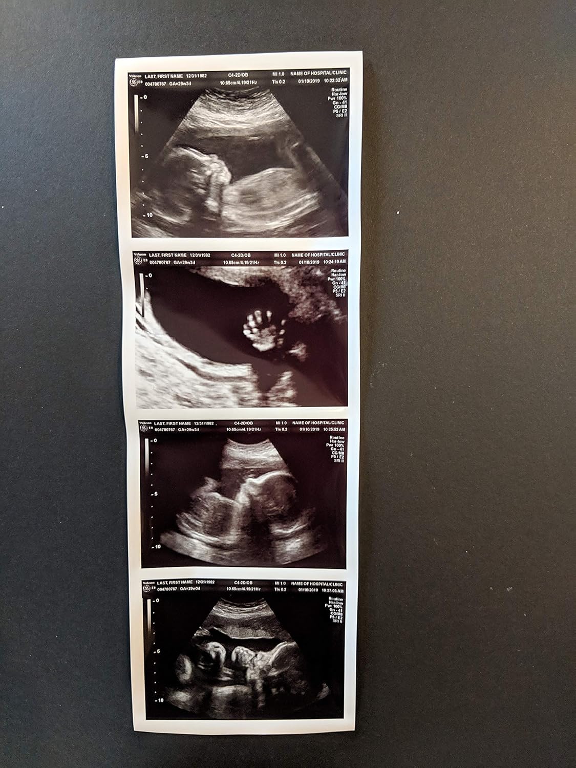 Photographs - Prank 2D Customized Fake Ultrasound Strip of 4 Photos