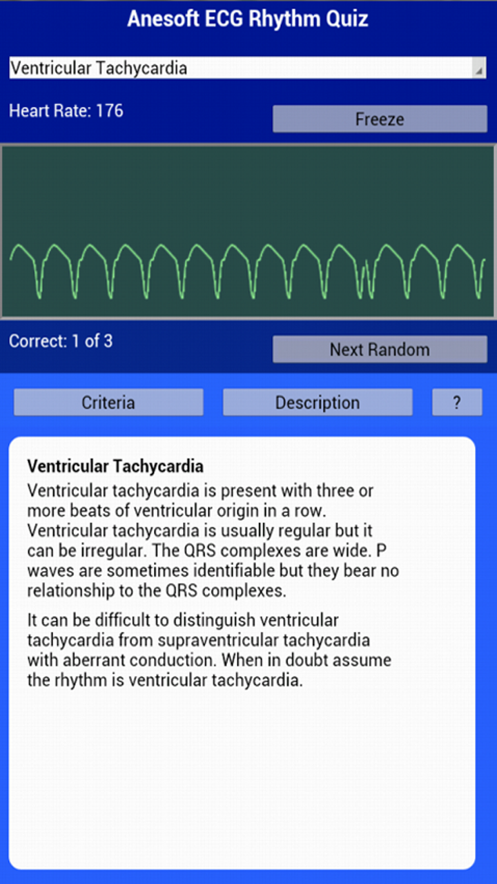 ECG Rhythms Quiz Apps & Games