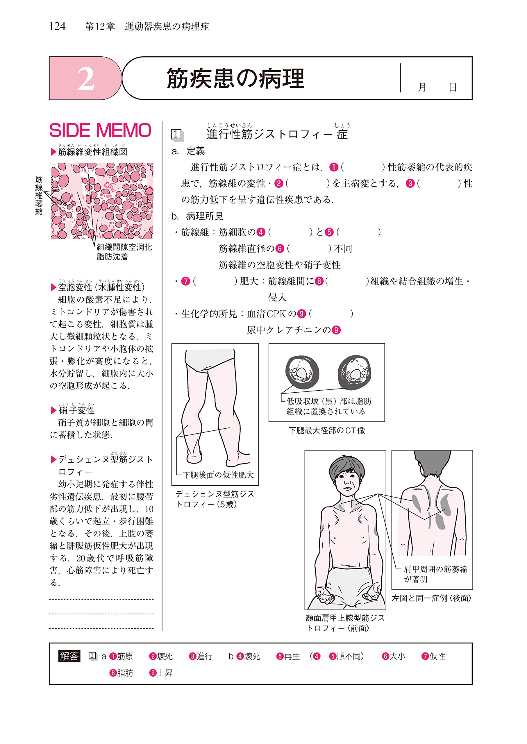 理学療法士 作業療法士 Pt Ot基礎から学ぶ 病理学ノート 第2版 9784263265581 Amazon Com Books