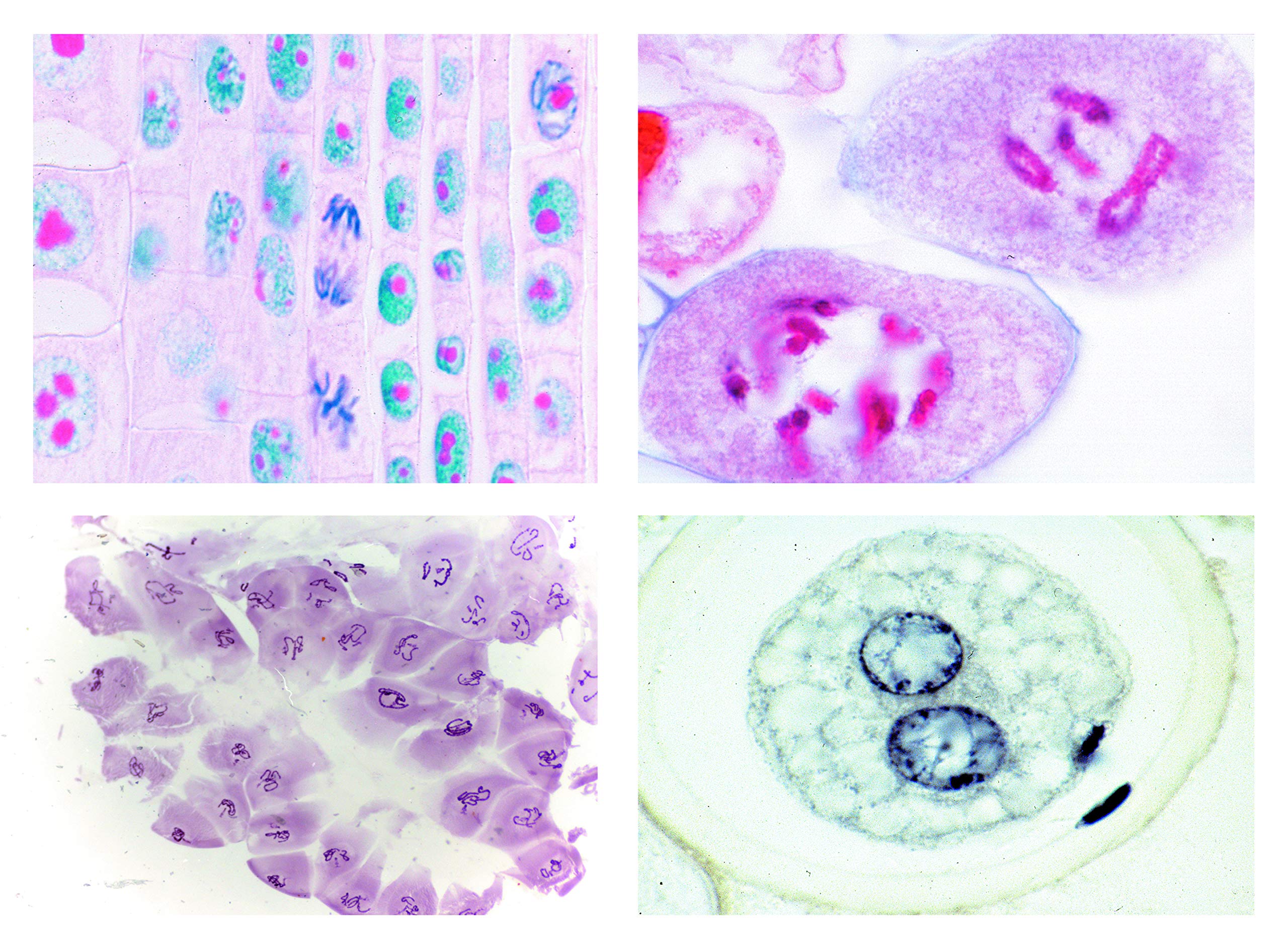 3B Scientific Biology Microscopy Micropräparate Series_ Thin Cut Rocks II