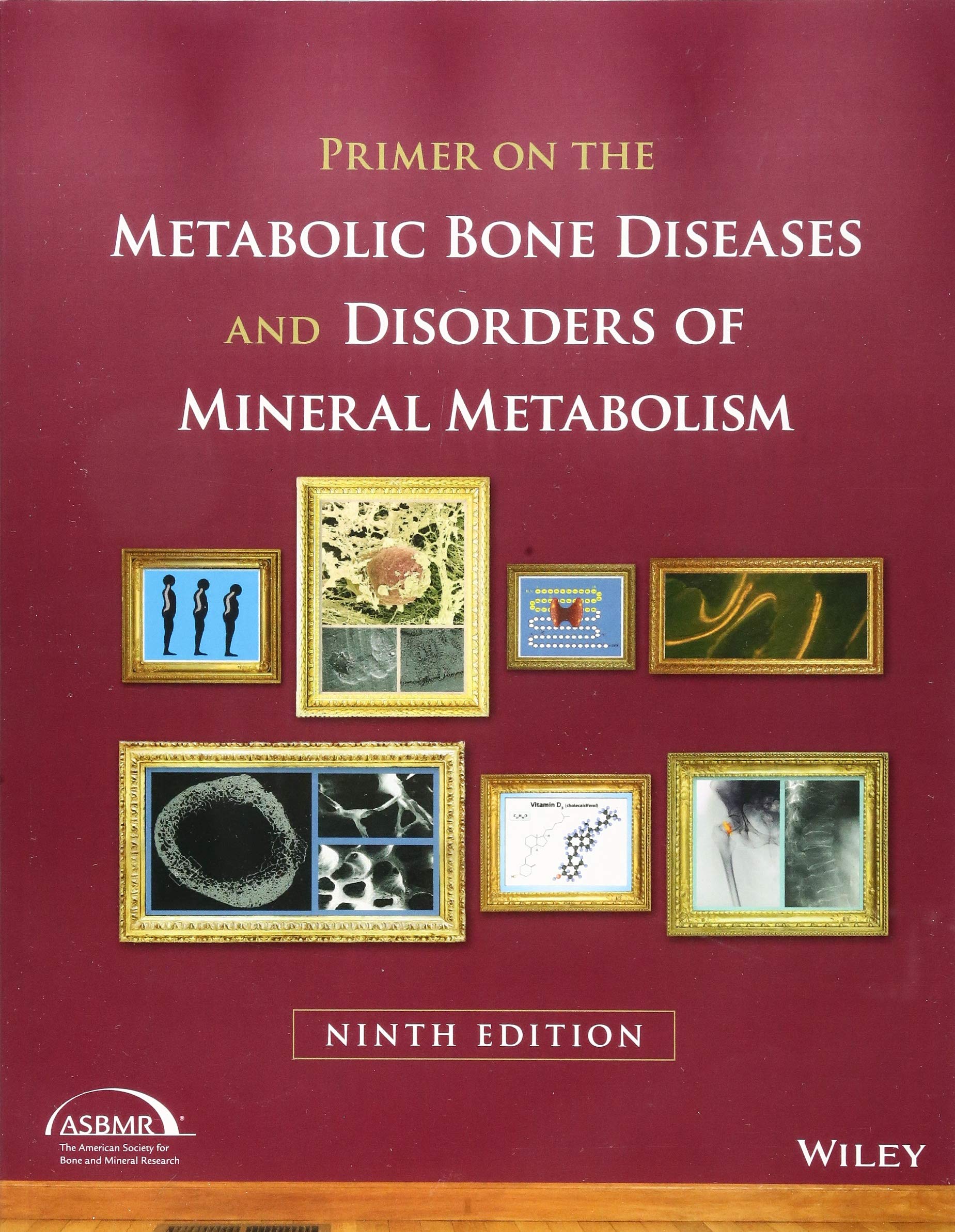 Buy Primer On The Metabolic Bone Diseases And Disorders Of Mineral Metabolism Book Online At Low Prices In India Primer On The Metabolic Bone Diseases And Disorders Of Mineral Metabolism Reviews Buy Primer On The Metabolic Bone Diseases And Disorders Of Mineral Metabolism Book Online At Low Prices In India Primer On The Metabolic Bone Diseases And Disorders Of Mineral Metabolism Reviews