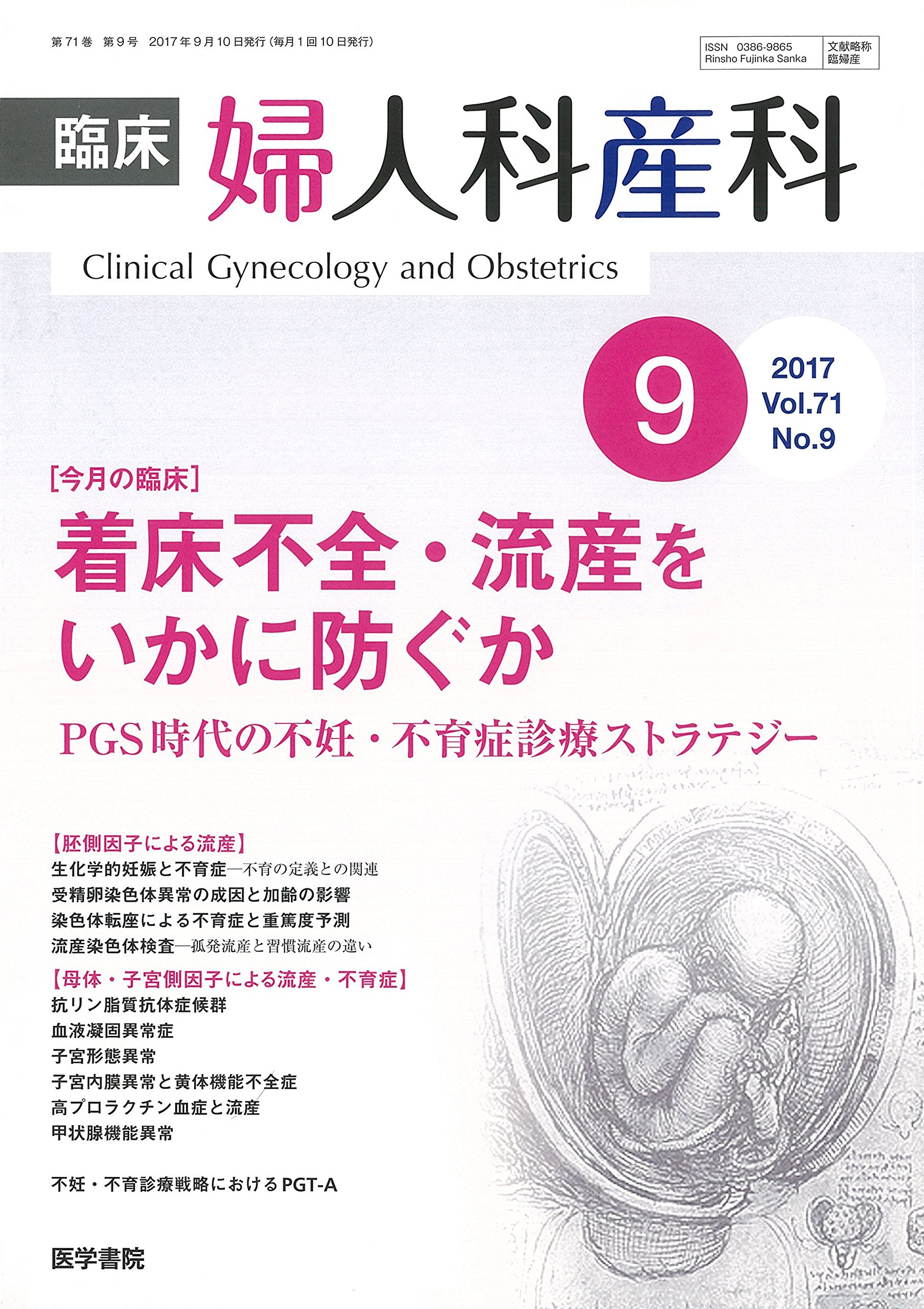 臨床婦人科産科 2017年 9月号 今月の臨床 着床不全 流産をいかに防ぐか Pgs時代の不妊 不育症診療ストラテジー 4910093290973 Amazon Com Books