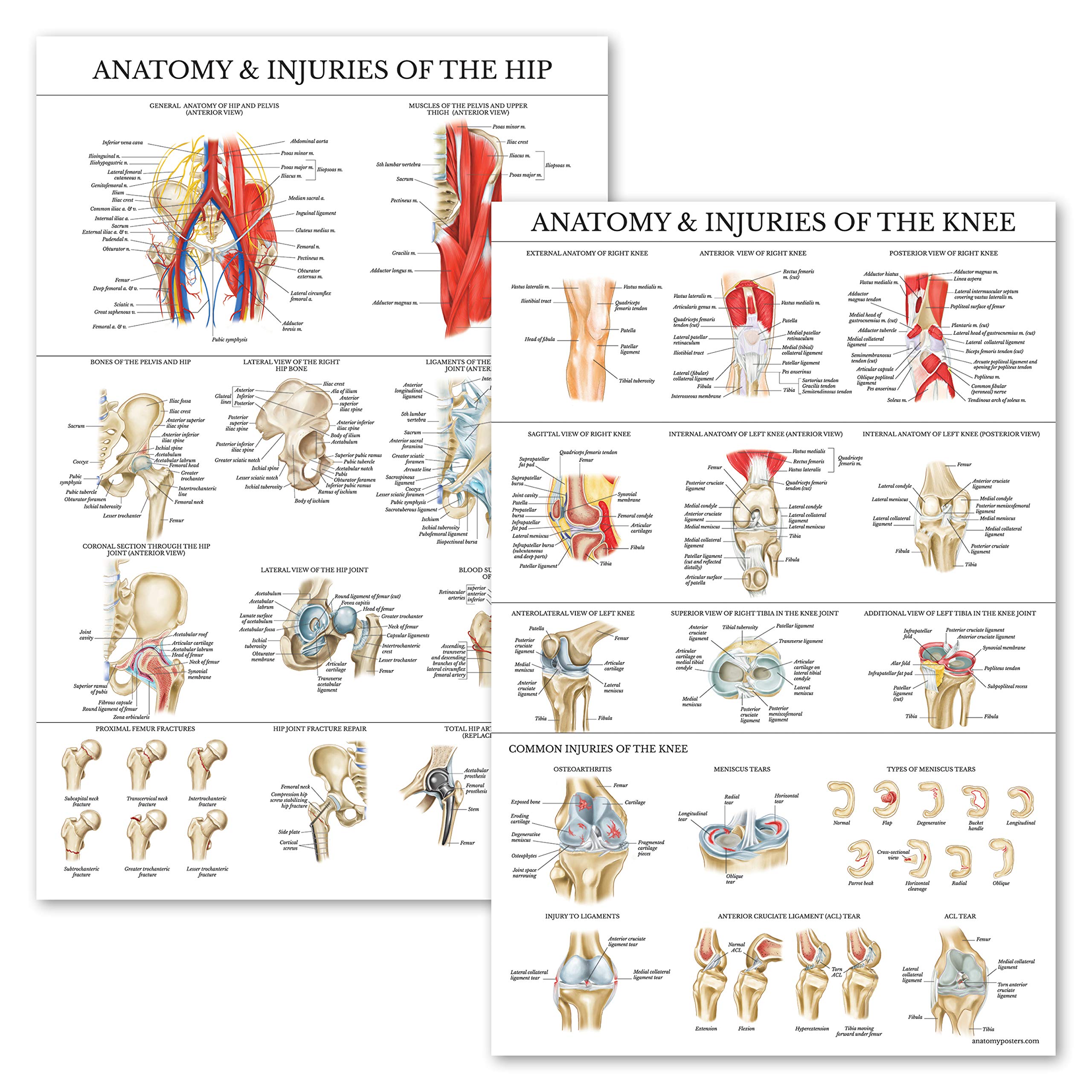 Palace Learning 2 Pack - Anatomy and Injuries of The Knee & Hip Poster Set - Anatomical Chart Set - Laminated 18" x 24"