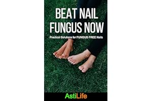 Beat Nail Fungus Now: Practical Solutions for Fungus Free Nails
