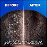 Head & Shoulders Citrus Fresh Anti Dandruff Shampoo 6 x 250ml view 4