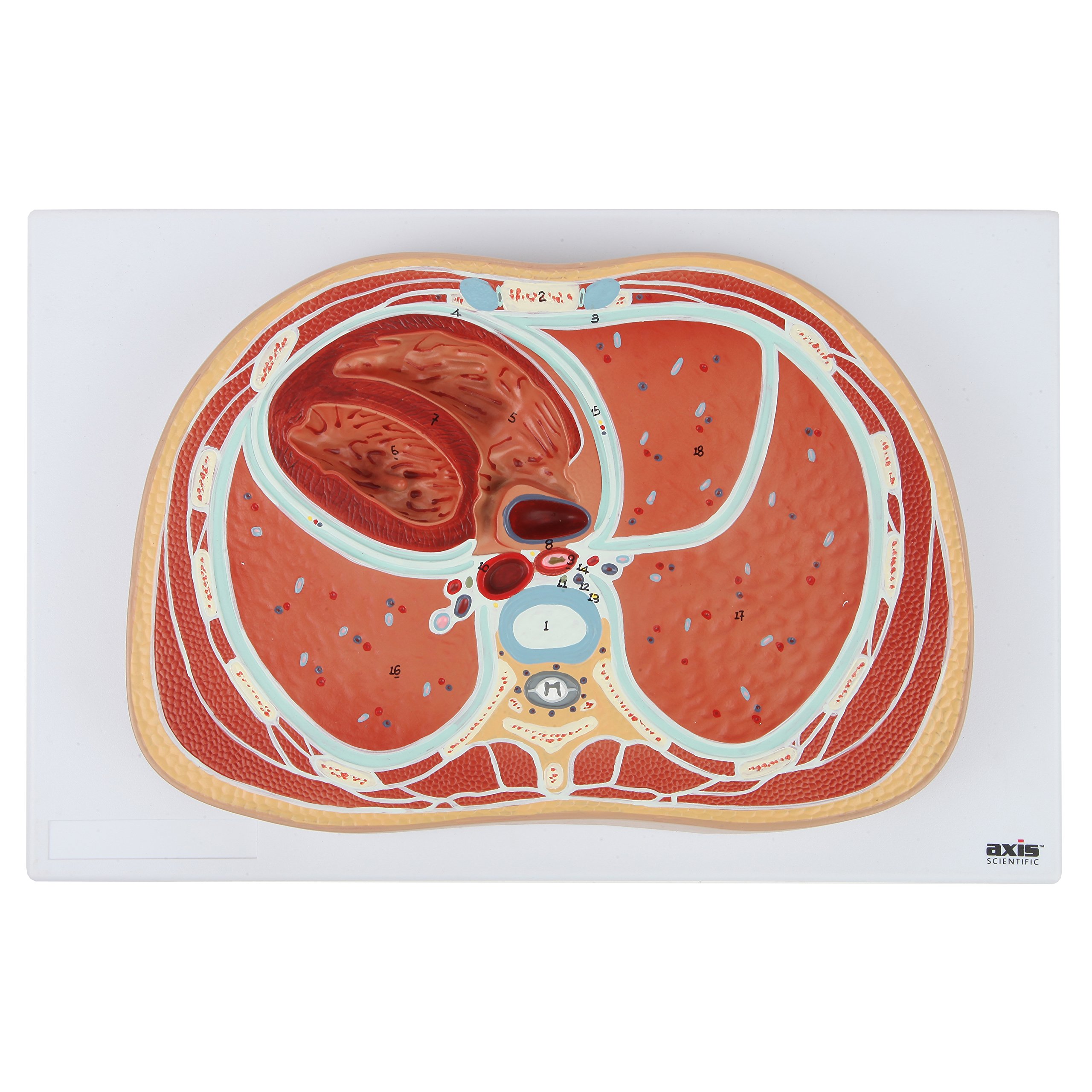 Axis Scientific Anatomy Model of Abdominal Cross Section at T6 | Offers View of Thorax at T6 Vertebrae | Depicts Vital Organs and Systems | Comes on Base | Includes Product Manual