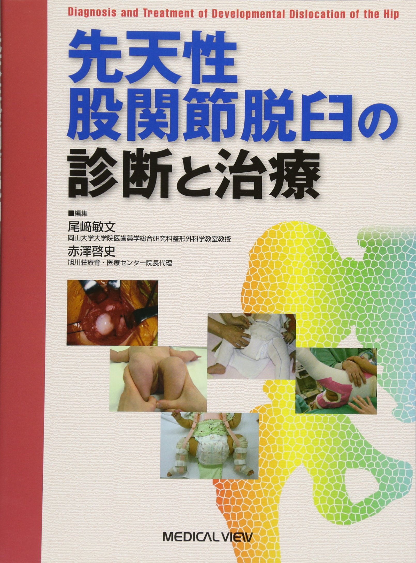 速達メール便 送料無料 本 先天性股関節脱臼の診断と治療 尾崎敏文 赤澤啓史 新品 本 人文 社会 医学 臨床医学外科系 整形外科学 プレミアム R4urealtygroup Com