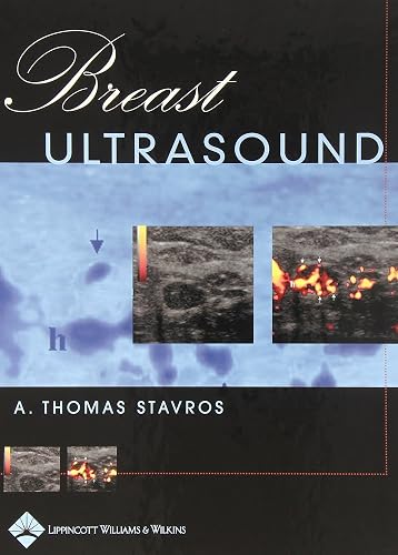 Download Breast Ultrasound PDF