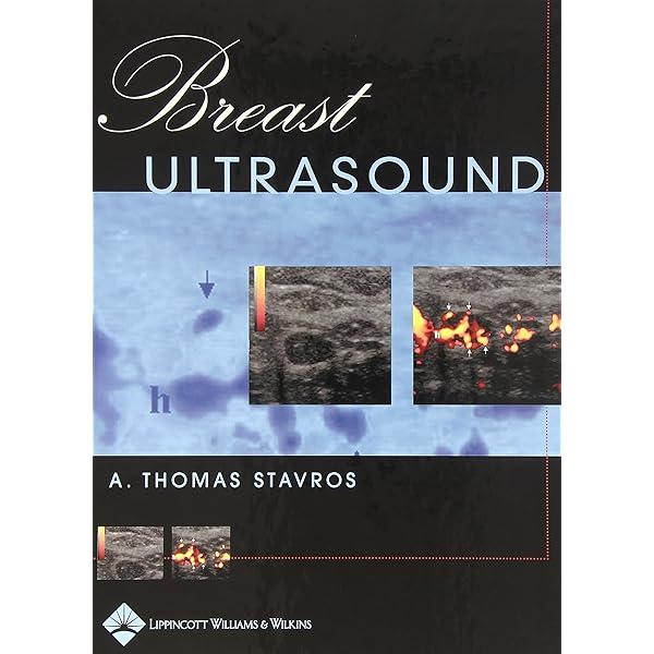 健康・医学 Breast Ultrasound A. Thomas Stavros 91rFXR-7yLL._UF1000,1000_QL80_.jpg