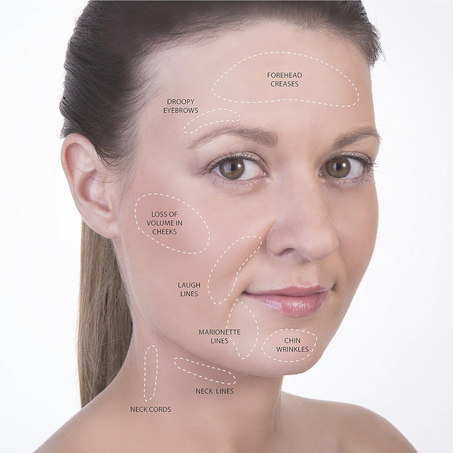 Face Cupping Set, Cupping Therapy Set for Face, Facial Cupping Sets, Ideal to Cup Your Cheeks, Chin and Lips - Image 4